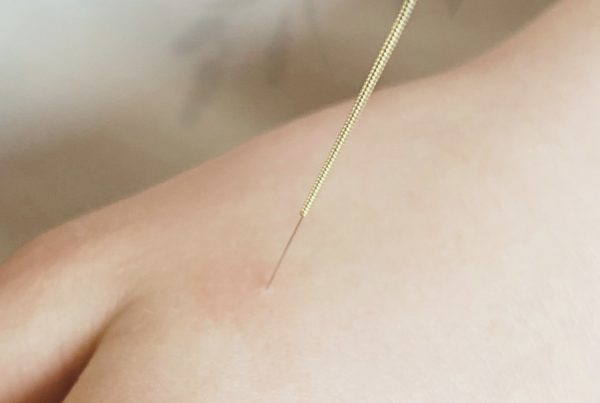 acupuncture, adolescence, ressource, santé